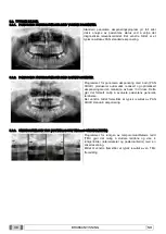 Preview for 625 page of Myray 708G Operator'S Manual