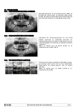 Preview for 690 page of Myray 708G Operator'S Manual