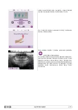 Preview for 747 page of Myray 708G Operator'S Manual