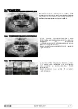 Preview for 755 page of Myray 708G Operator'S Manual