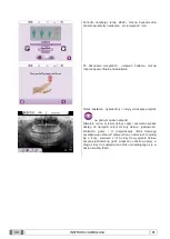 Preview for 877 page of Myray 708G Operator'S Manual