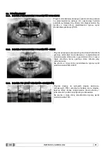 Preview for 885 page of Myray 708G Operator'S Manual