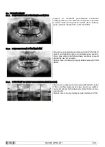 Preview for 950 page of Myray 708G Operator'S Manual