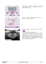 Preview for 1007 page of Myray 708G Operator'S Manual