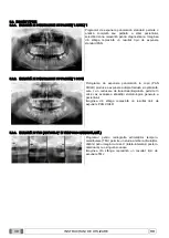 Preview for 1080 page of Myray 708G Operator'S Manual