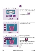 Preview for 1083 page of Myray 708G Operator'S Manual