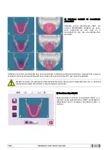 Preview for 1085 page of Myray 708G Operator'S Manual