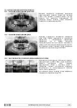 Preview for 1145 page of Myray 708G Operator'S Manual