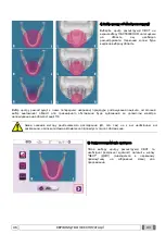 Preview for 1150 page of Myray 708G Operator'S Manual