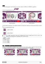 Preview for 28 page of Myray hyperion X9 Operator'S Manual