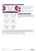 Preview for 45 page of Myray hyperion X9 Operator'S Manual