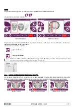 Preview for 96 page of Myray hyperion X9 Operator'S Manual