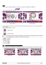 Preview for 164 page of Myray hyperion X9 Operator'S Manual