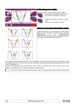 Preview for 249 page of Myray hyperion X9 Operator'S Manual