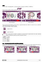 Preview for 368 page of Myray hyperion X9 Operator'S Manual