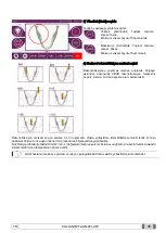 Preview for 521 page of Myray hyperion X9 Operator'S Manual