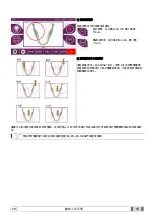 Preview for 589 page of Myray hyperion X9 Operator'S Manual