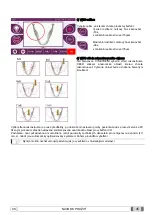 Preview for 997 page of Myray hyperion X9 Operator'S Manual