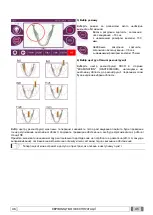 Preview for 1201 page of Myray hyperion X9 Operator'S Manual