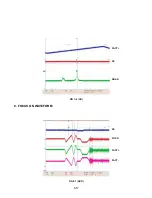 Preview for 28 page of NAD T515C Service Manual