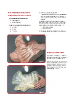 Preview for 4 page of Nasco Lifeform LF01087U Instruction Manual