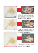 Preview for 5 page of Nasco Lifeform LF01087U Instruction Manual