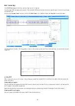 Предварительный просмотр 49 страницы natus Dantec Keypoint G4 User'S And Service Manual