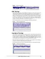 Предварительный просмотр 15 страницы natus OLYMPIC CFM 6000 Operator'S Manual