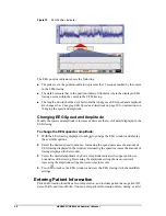 Предварительный просмотр 26 страницы natus OLYMPIC CFM 6000 Operator'S Manual