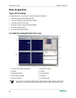 Предварительный просмотр 52 страницы natus XLTEK Protektor32 Instructions For Use Manual