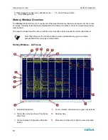 Предварительный просмотр 72 страницы natus XLTEK Protektor32 Instructions For Use Manual