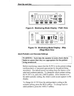 Preview for 36 page of Nellcor N-395 Operator'S Manual