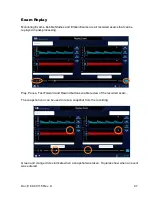 Preview for 47 page of Neural Analytics Lucid M1 User Manual