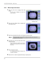 Предварительный просмотр 72 страницы Nidek Medical ICE-1000 Operator'S Manual