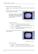 Предварительный просмотр 80 страницы Nidek Medical ICE-1000 Operator'S Manual