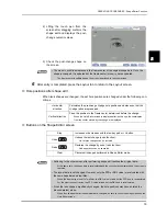 Preview for 89 page of Nidek Medical Ice 900 Operator'S Manual