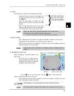 Preview for 93 page of Nidek Medical Ice 900 Operator'S Manual