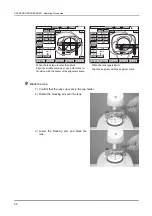 Preview for 34 page of Nidek Medical ICE mini Operator'S Manual