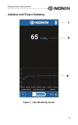 Preview for 17 page of Nonin Sensmart H500 Operator'S Manual