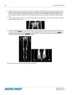 Preview for 158 page of Norland Elite 437A150 Operator'S Manual