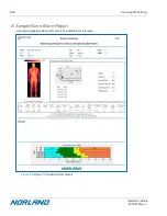 Preview for 164 page of Norland Elite 437A150 Operator'S Manual