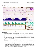 Preview for 23 page of North-Vision Tech Deluxe-100 User Manual