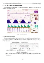 Preview for 28 page of North-Vision Tech Deluxe-100 User Manual