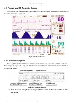 Preview for 28 page of North-Vision Tech Elegant-1100 User Manual