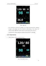 Предварительный просмотр 41 страницы Northern Meditec Taurus E Operator'S Manual