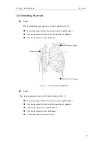 Предварительный просмотр 73 страницы Northern Meditec Taurus E Operator'S Manual