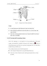 Предварительный просмотр 74 страницы Northern Meditec Taurus E Operator'S Manual