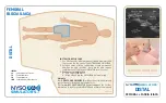 NYSORA SIMULATORS DISTAL ADDUCTOR CANAL BLOCK Manual preview