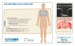 Предварительный просмотр 11 страницы NYSORA SIMULATORS DISTAL ADDUCTOR CANAL BLOCK Manual