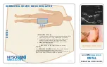 Предварительный просмотр 12 страницы NYSORA SIMULATORS DISTAL ADDUCTOR CANAL BLOCK Manual